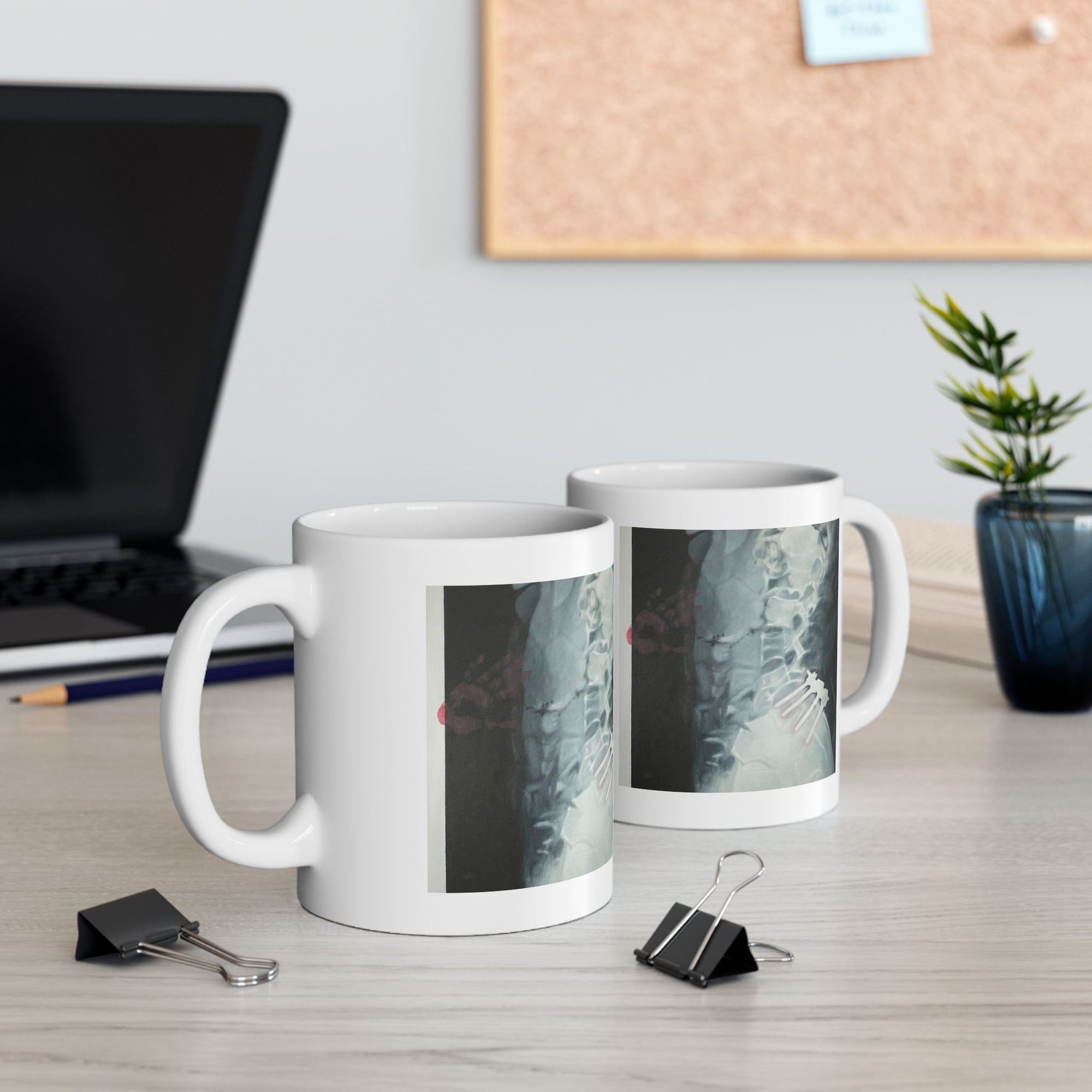 Care mug