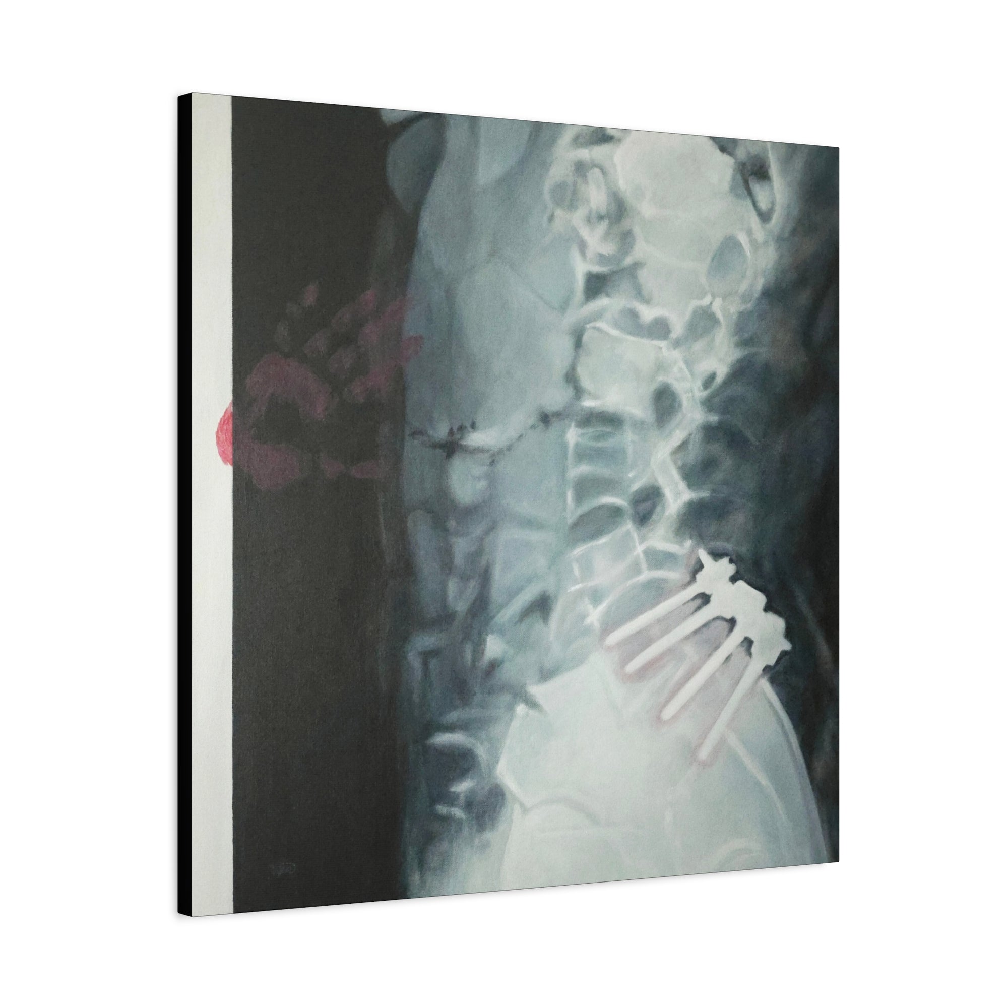 Care Stretched Canvas