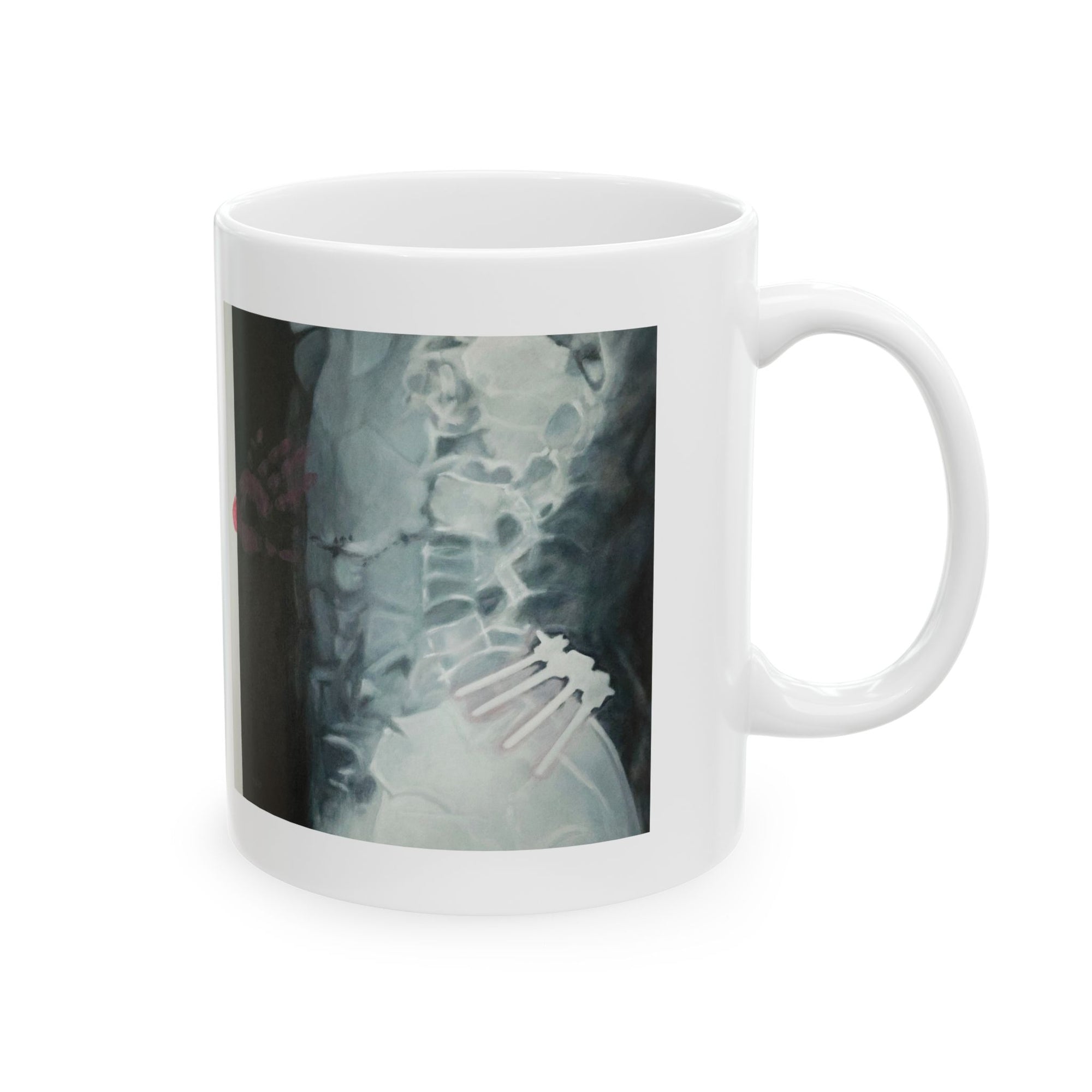 Care mug
