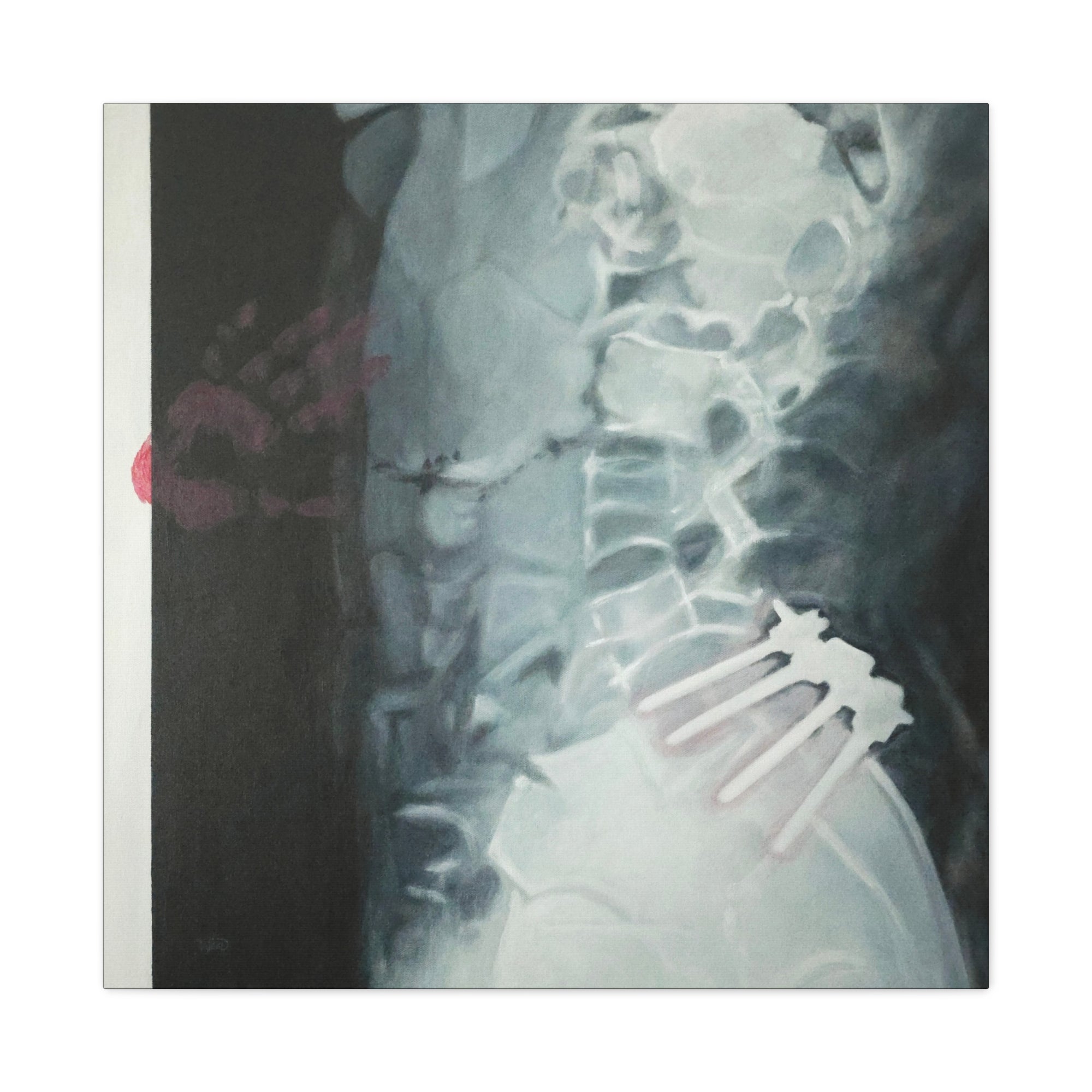 Care Stretched Canvas